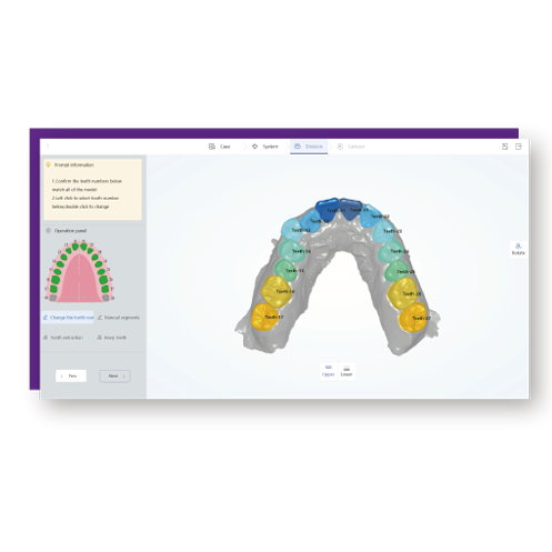 eletra-camera-empreinte-optique-simulation-orthodontique